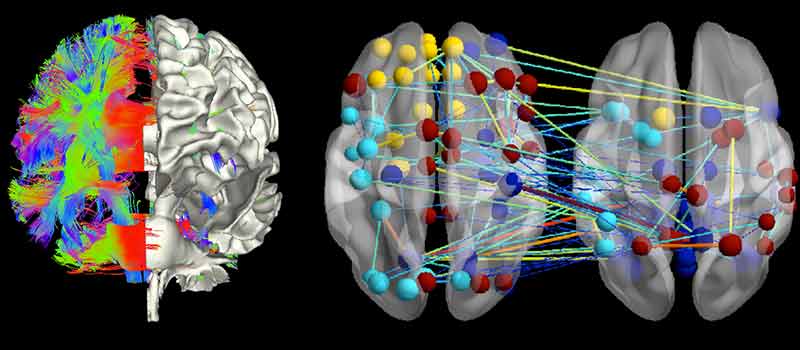 Cambiamenti neurologici psicoterapia del disturbo ossessivo compulsivo